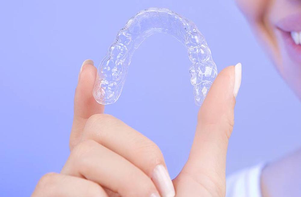 Clear aligners used to straighten teeth